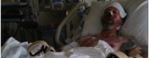 USA : il se fait amputer après avoir été léché par un chien