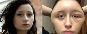 Colorants pour cheveux : une jeune fille qui a failli mourir dénonce