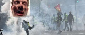 Gilets jaunes : une fake news d’un blessé circule sur la toile