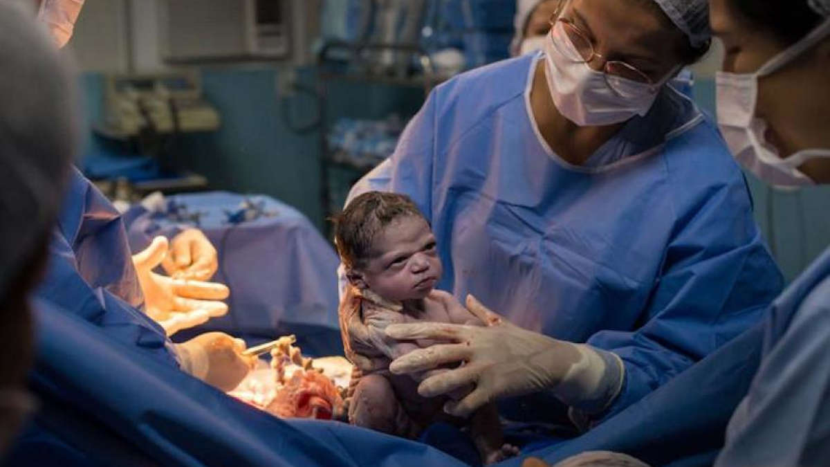 La photo de ce bébé juste à la naissance fait le buzz sur la toile
