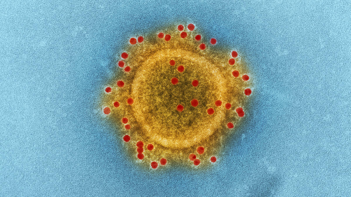 Iran : 23 parlementaires contaminés par le coronavirus
