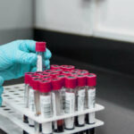 Laboratoire, médecine, analyse