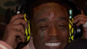 Lil Uzi Vert s'est fait arracher le diamant sur son front