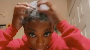 Glue au lieu du gel : une américaine a les cheveux collés depuis un mois, un chirurgien à son secours