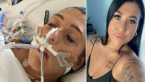 Une femme dans le coma à cause d’une « bactérie mangeuse de chair »
