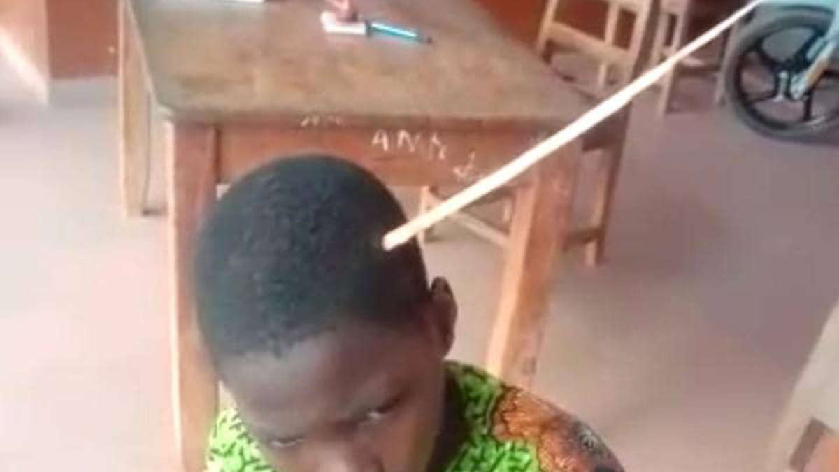 Bénin: un bâton coincé dans la tête d'un enfant battu par son père