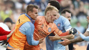 Football: un supporter blesse un gardien de but avec une poubelle