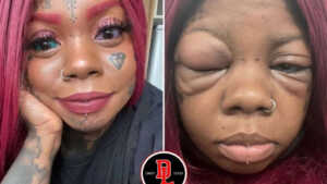 Une mère devient aveugle en tatouant ses globes oculaires pour imiter une influenceuse