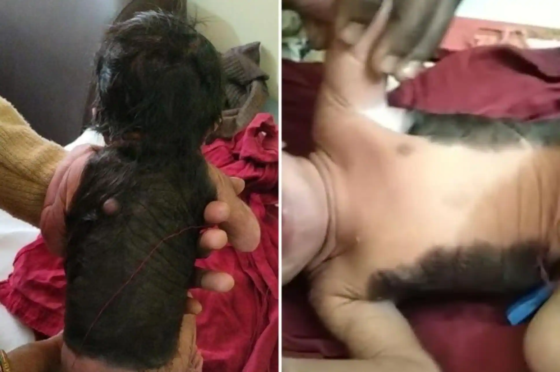 Un bébé nait avec le corps couvert à 60% de cheveux en Inde