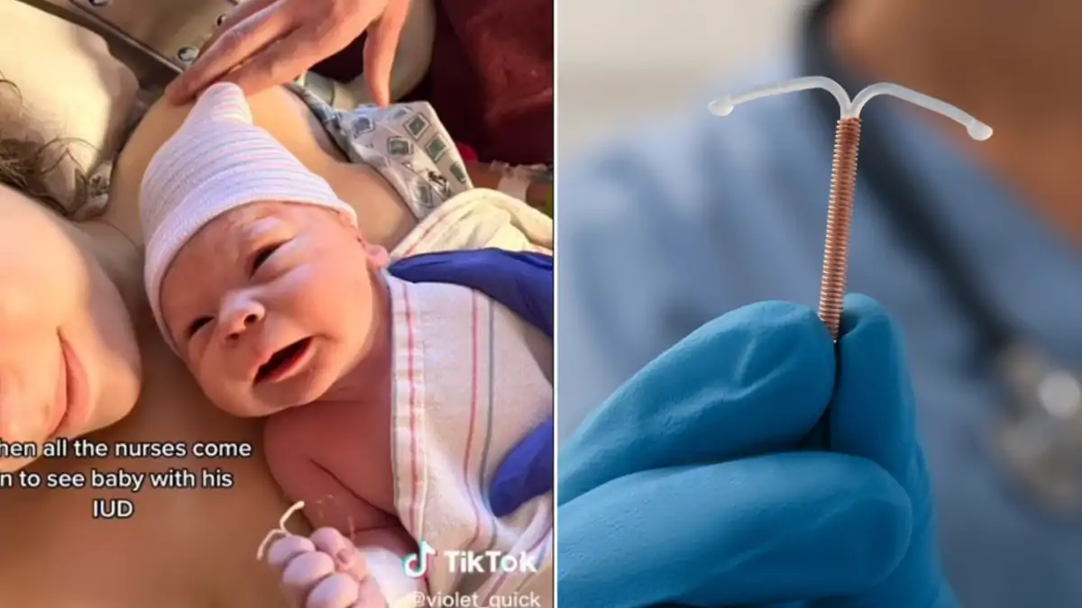 Insolite: un bébé naît avec le sterilet de sa mère en main