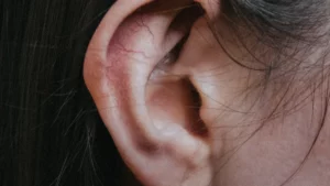 Une araignée venimeuse retirée de l'oreille d’une femme aux urgences