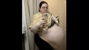 À 20 ans, elle se fait retirer un kyste ovarien de 47kg