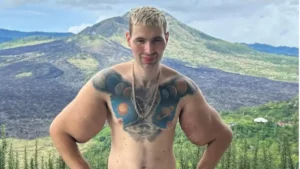 Ce bodybuilder russe est fier de ses «muscles de Synthol»