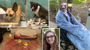 Mordue plus de 800 fois par deux chiens, elle subit 18 opérations pour se refaire le visage