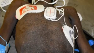 Un prisonnier afro-américain meurt après avoir été "dévoré" par des insectes