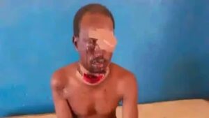 Un homme grièvement blessé par son épouse dans la nuit car elle soupçonnait qu'il voulait prendre une deuxième femme